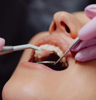 Close-up of dental procedure highlighting hygiene and patient care.
