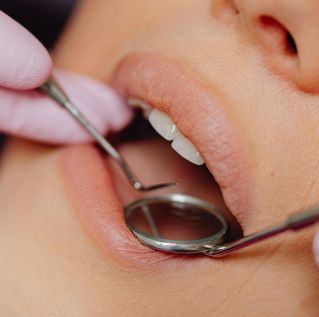 Close-up view of a patient's dental check-up using dental mirror and tools.